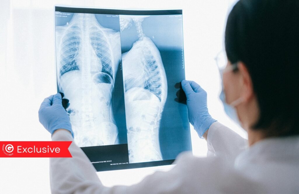 South Africa’s Battle Against Tuberculosis